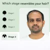 Regrow 10% – Advanced Hair Regrowth Spray for Thinning Hair